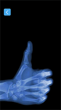 X射線模擬器下載